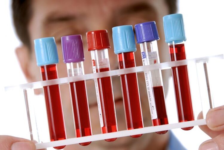 Test sanguin pour diagnostiquer les maladies des vers